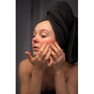 Алергія і шкіра: чому висипання — це не завжди косметична проблема