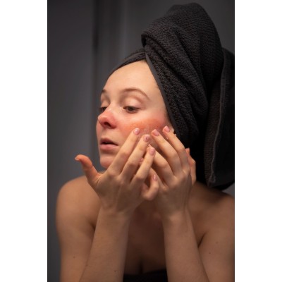 Алергія і шкіра: чому висипання — це не завжди косметична проблема