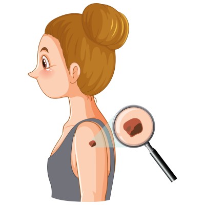 Натуральний захист шкіри: як справлятися з папіломами, грибком і мікротріщинами без агресивної хімії