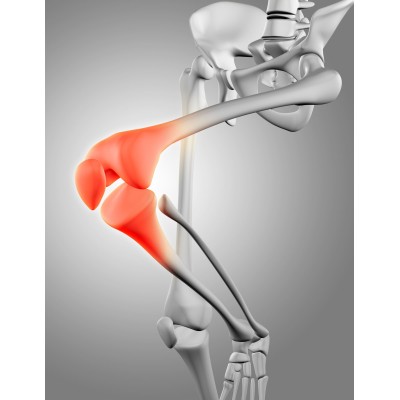 Хрустять коліна? Як відновити хрящ до того, як почнеться артроз